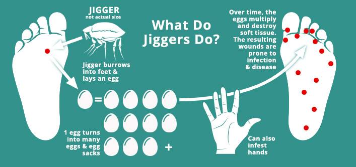 Jigger Awareness