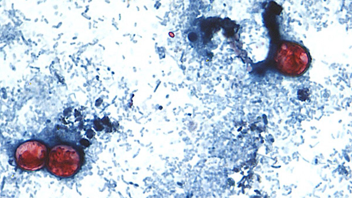 Cyclospora